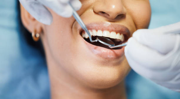 Best Emergency Cosmetic Dentistry (e.g., broken veneers) in Churchill, OH
